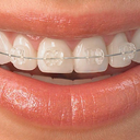 orthodonticsarlingtonheight-blog